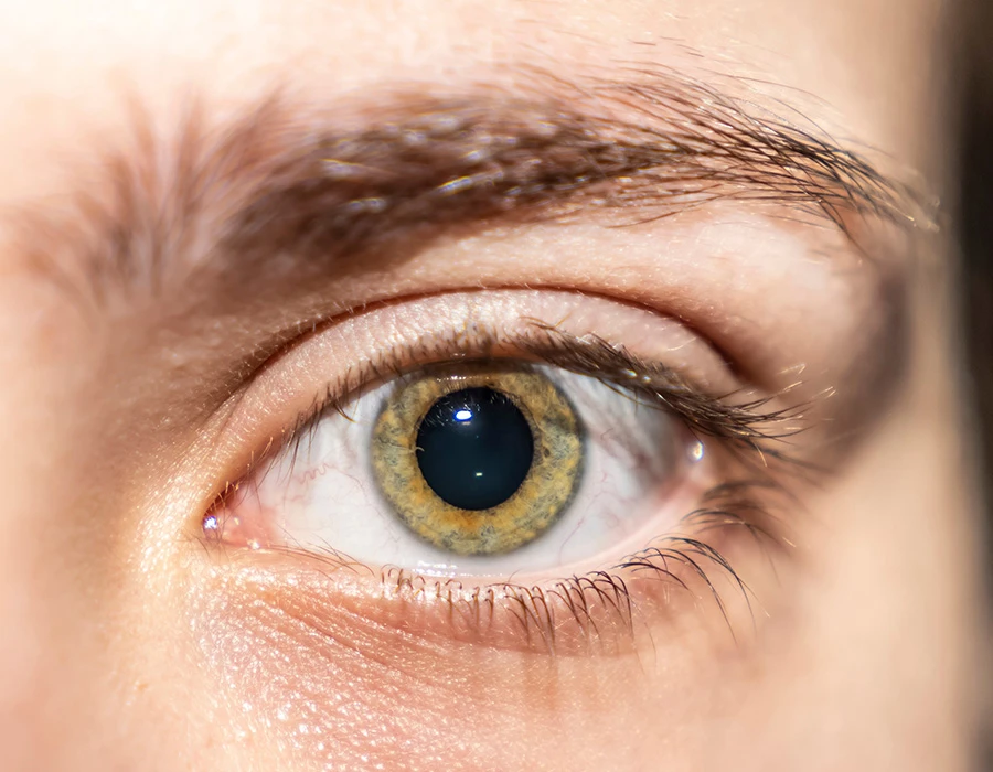 Close-up van een groenbruin oog met een grote, sterk verwijde pupil.