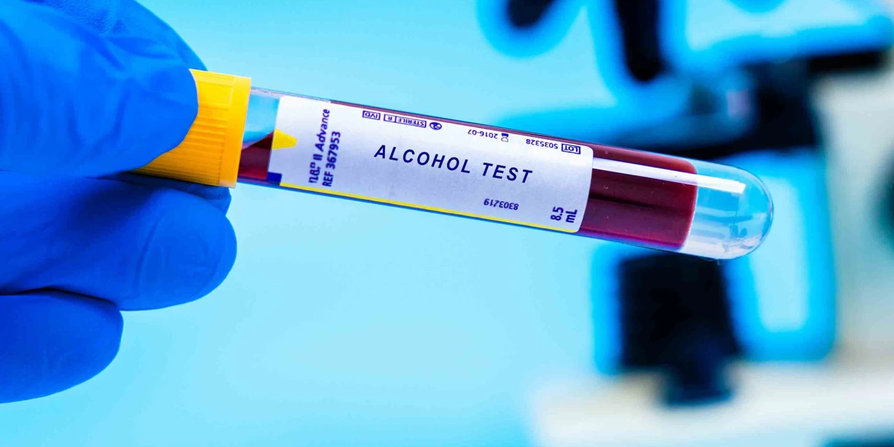 Bloedtest toont alcoholpromillage in buisje in laboratorium.