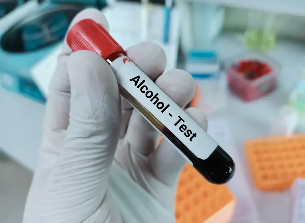 alcohol-test-laboratorium Buisje afgenomen bloed met daarop een sticker met Alcohol test.